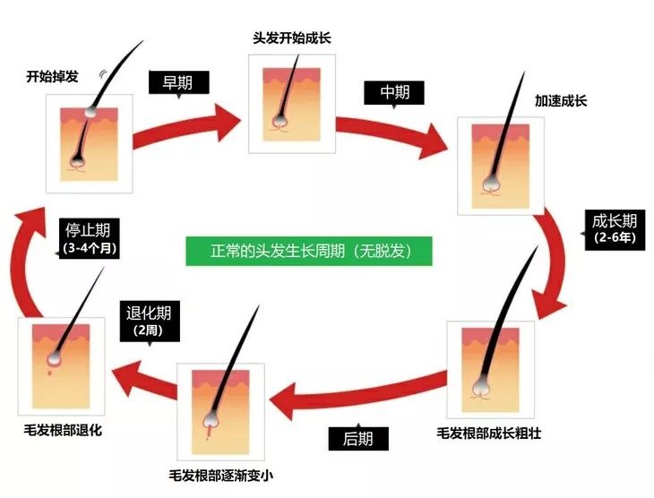 OMG | 植发后第四个月，本CO男友拿起了王鸥同款生发液