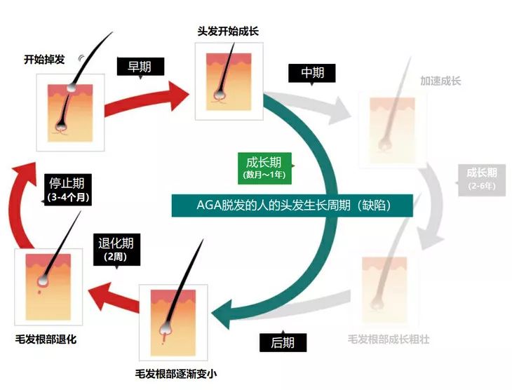 OMG | 植发后第四个月，本CO男友拿起了王鸥同款生发液