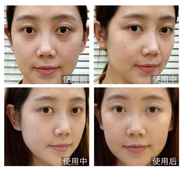 眼霜中的爱马仕！清爽不长脂肪粒，去黑眼圈效果秒2000元腊梅，亲测有效