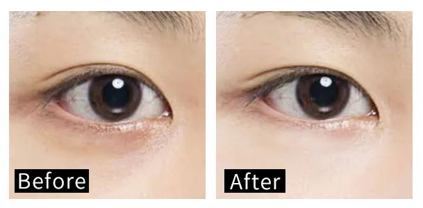 眼霜中的爱马仕！清爽不长脂肪粒，去黑眼圈效果秒2000元腊梅，亲测有效