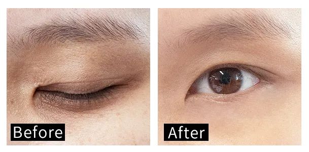 眼霜中的爱马仕！清爽不长脂肪粒，去黑眼圈效果秒2000元腊梅，亲测有效