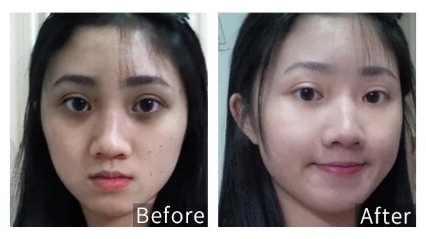 眼霜中的爱马仕！清爽不长脂肪粒，去黑眼圈效果秒2000元腊梅，亲测有效