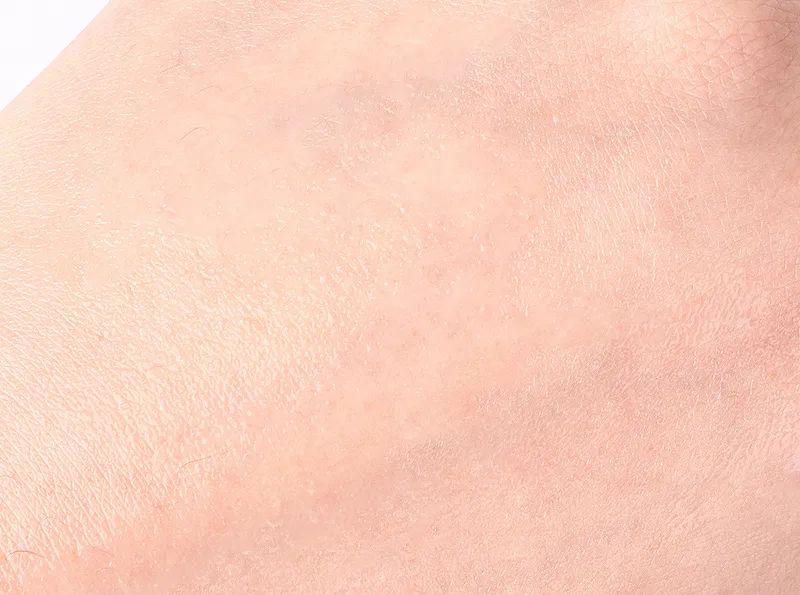 眼霜中的爱马仕！清爽不长脂肪粒，去黑眼圈效果秒2000元腊梅，亲测有效