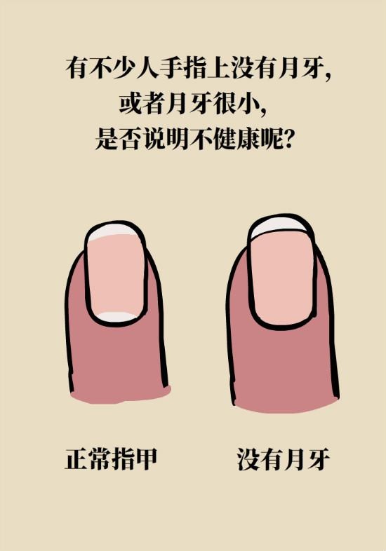 手指没有月牙怎么办