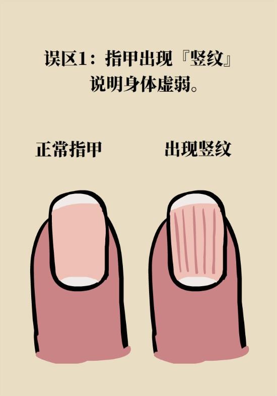 手指没有月牙怎么办