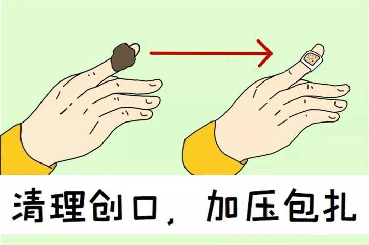 指甲掉了怎么处理伤口(不小心伤到手) - seo葵花宝典