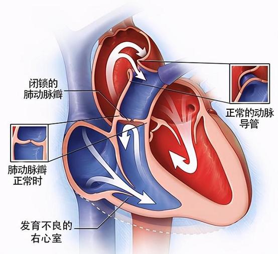 新生儿是指多大的婴儿 新生儿特点