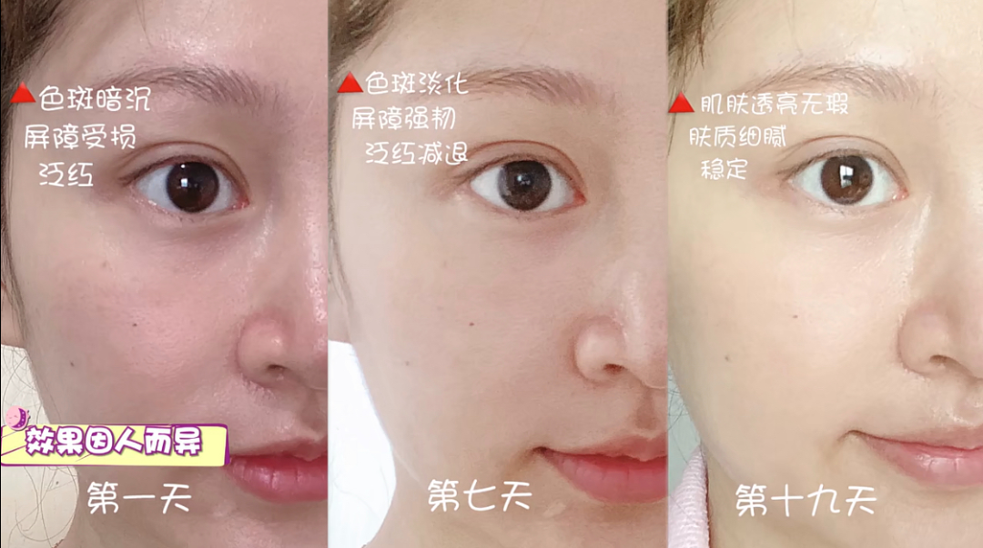 4折抢科颜氏淡斑精华，早晚两泵，白雪公主不是梦