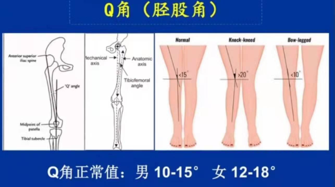 宝宝1岁感觉有点“O型腿”，用不用矫正？