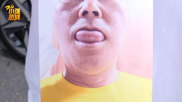 新车开了一个月，男子感觉要窒息了：舌头比原来大了4倍