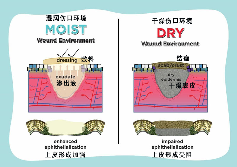 这些对抗疤痕的好方法，你都知道吗？