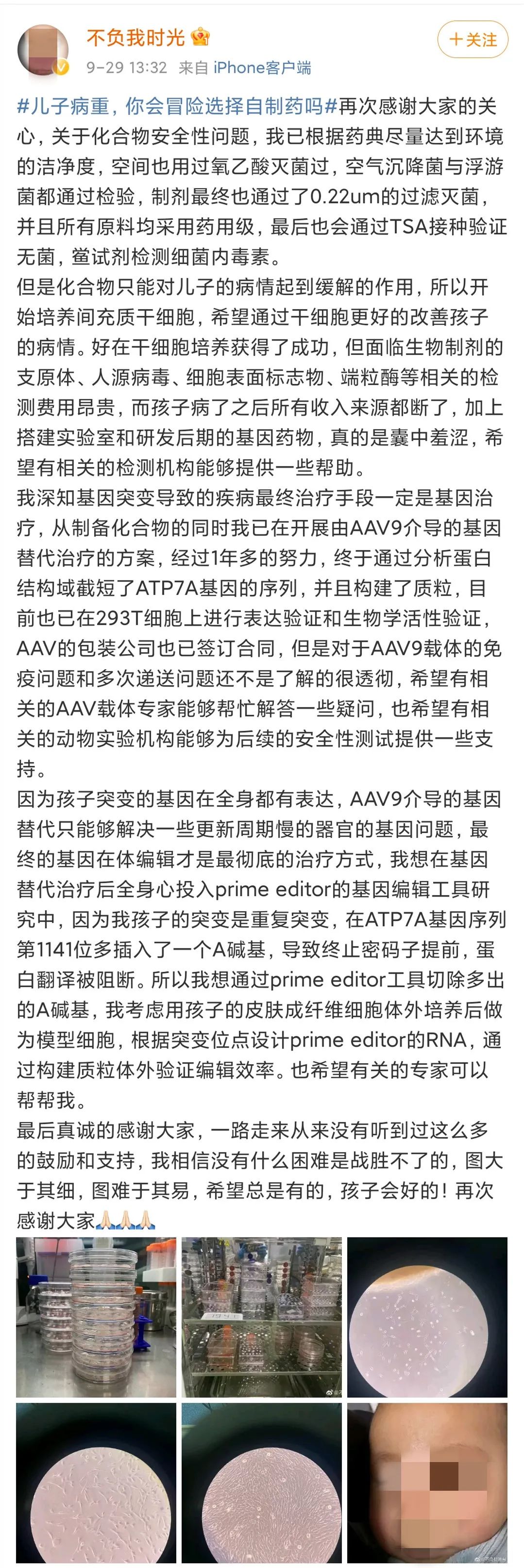 儿子患罕见病，高中学历父亲冒险选择自制药？当事人回应