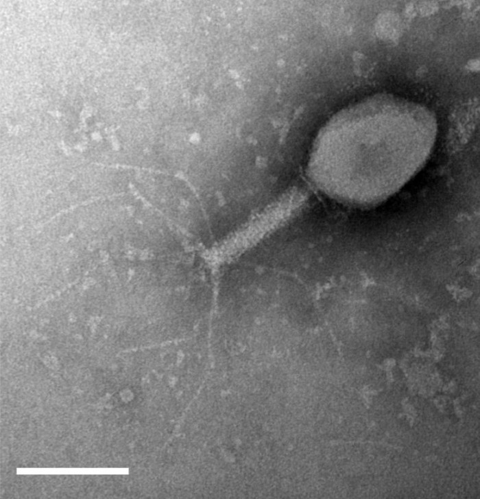 研究发现细菌进化出多种防御系统，以保护其免受病毒侵害-第2张图片-IT新视野