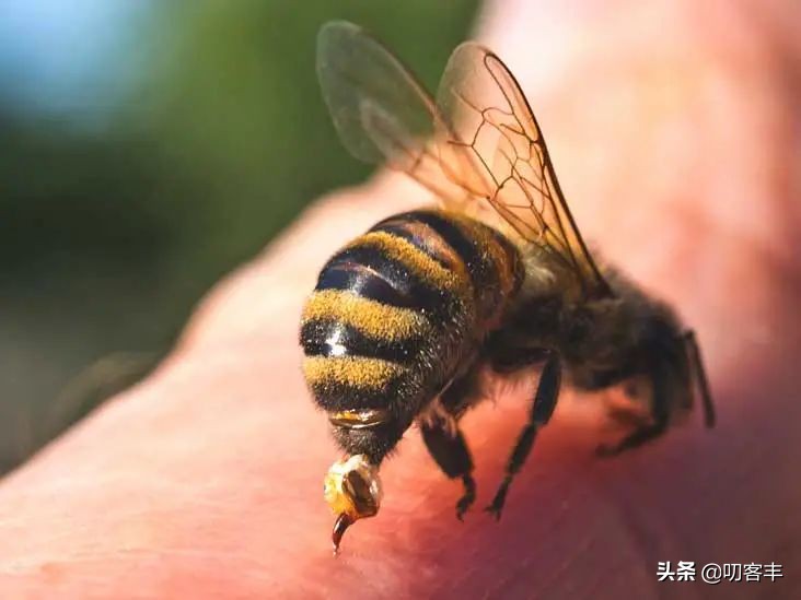 被蜂蛰了怎么办？