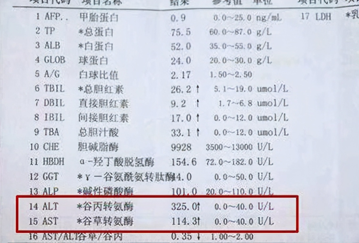 转氨酶过高如何有效降低？护肝降酶方法大全
