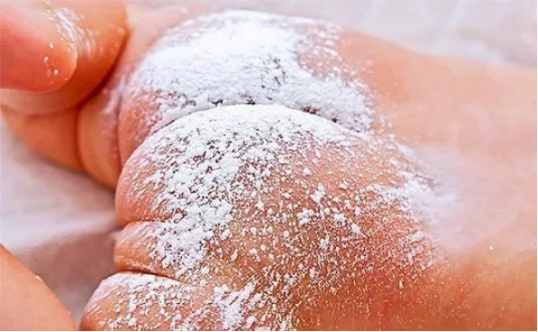 帮助孩子摆脱痱子困扰 这3大痱子粉挑选细则不容错过