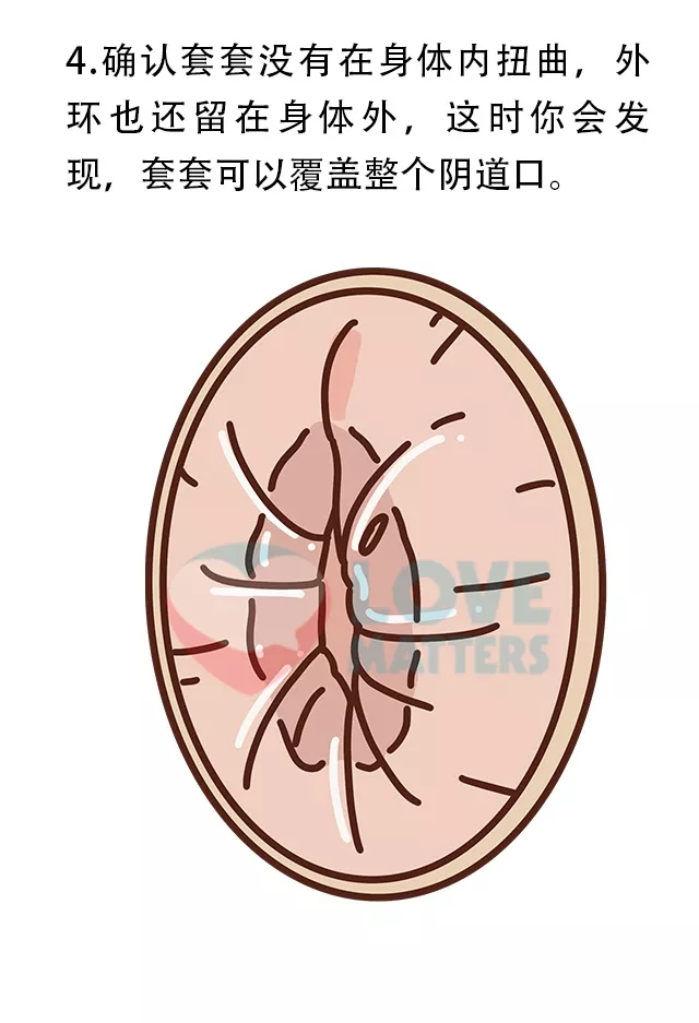 女用避孕套使用方法图解