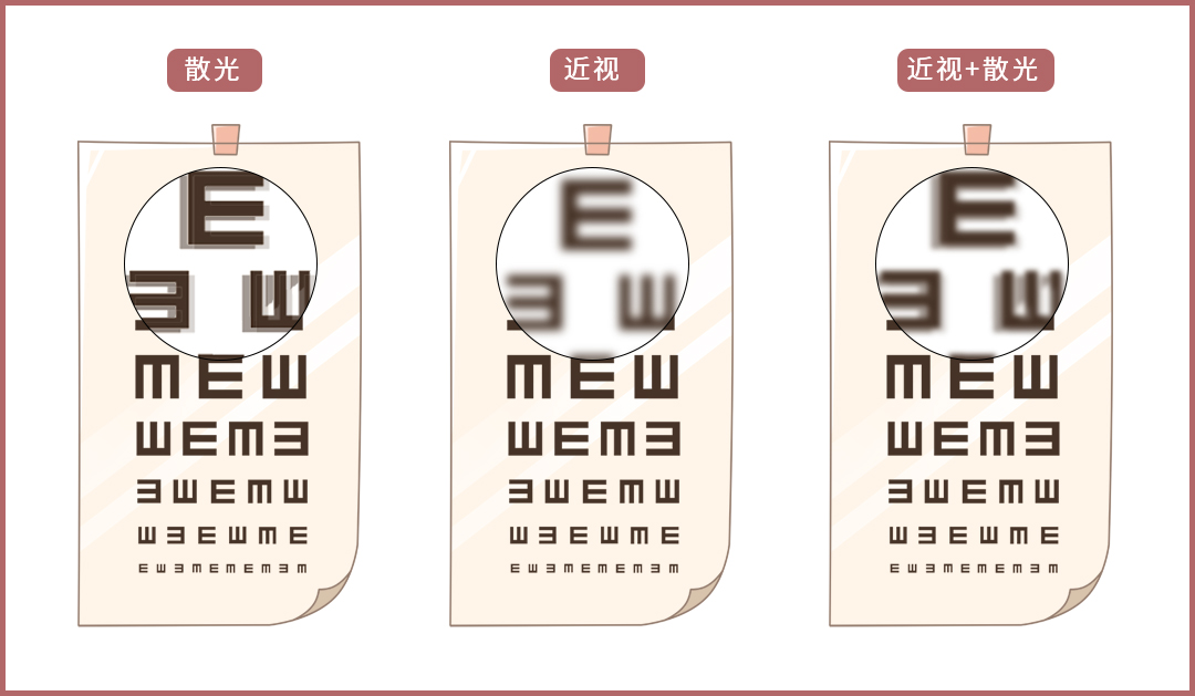 近视眼和老花眼可以抵消？网上配镜靠谱吗？一文全知道