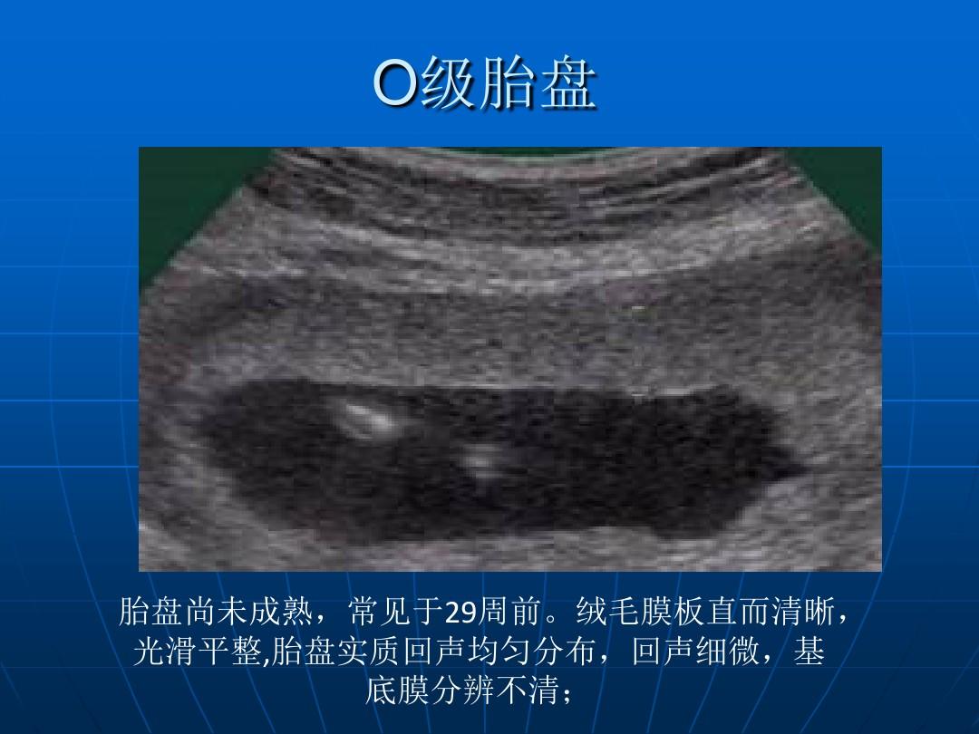 如何判断胎盘成熟度 怎么看胎盘发育得好不好