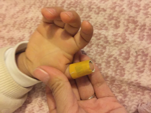 “孩子出生就会得腱鞘炎，这是胡扯吗？”