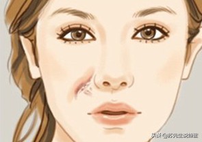 过期、轻微变质的蜂蜜别扔，大有用处