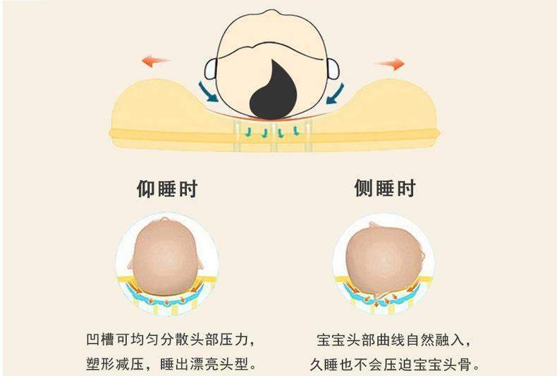 嬰兒扁頭矯正期最晚(如何防止寶寶睡偏頭) - 樂寶寶貝