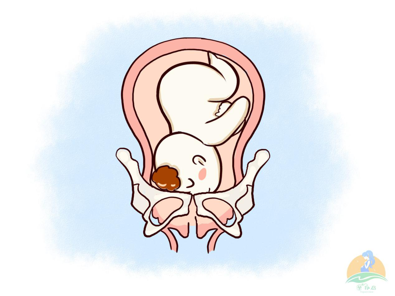 当然,以上讲的主要是头位的情况,实际上胎位大体上分三种情况.