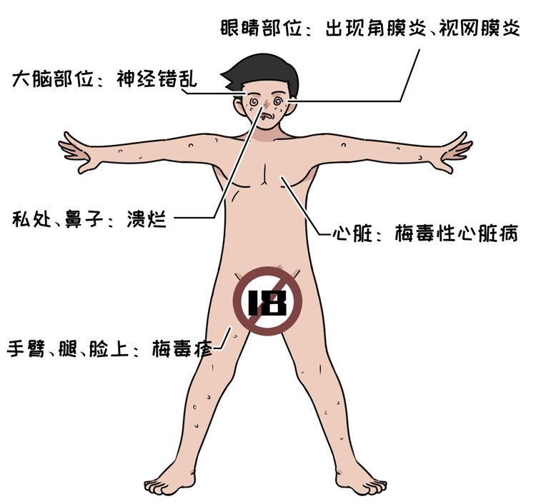 为什么有的男人会选择嫖娼？一次嫖娼会带来多少性病？长点记性吧