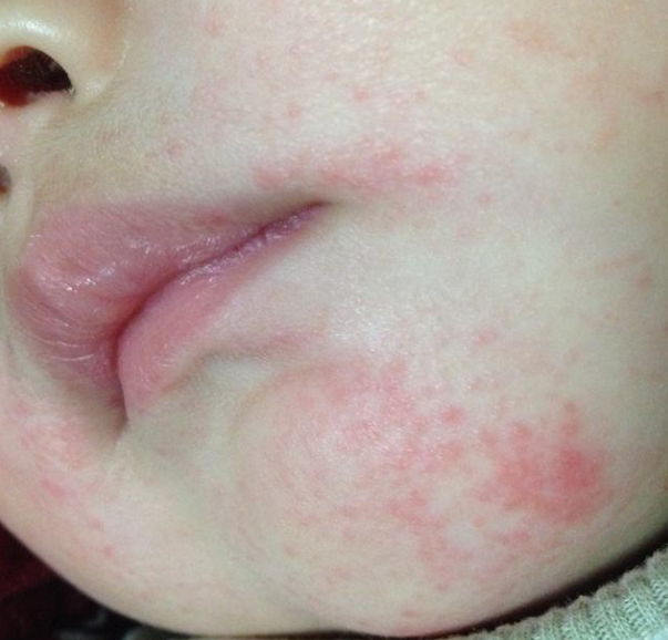 婴儿老吐泡泡怎么回事(小宝宝总是) - 乐宝宝贝