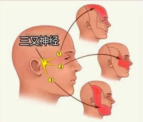 这种痛,常被以为是牙痛,其实是"神经病"