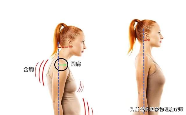 肩周炎是导致肩痛的原因，结果大家都进入误区，咋不想想其他病因