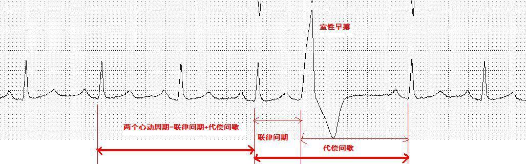 检查心脏，心电图、心脏彩超哪个更准确？看看医生怎么说