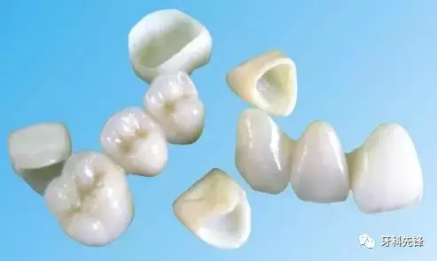 烤瓷牙、全瓷牙哪个更好?优缺点对比分析
