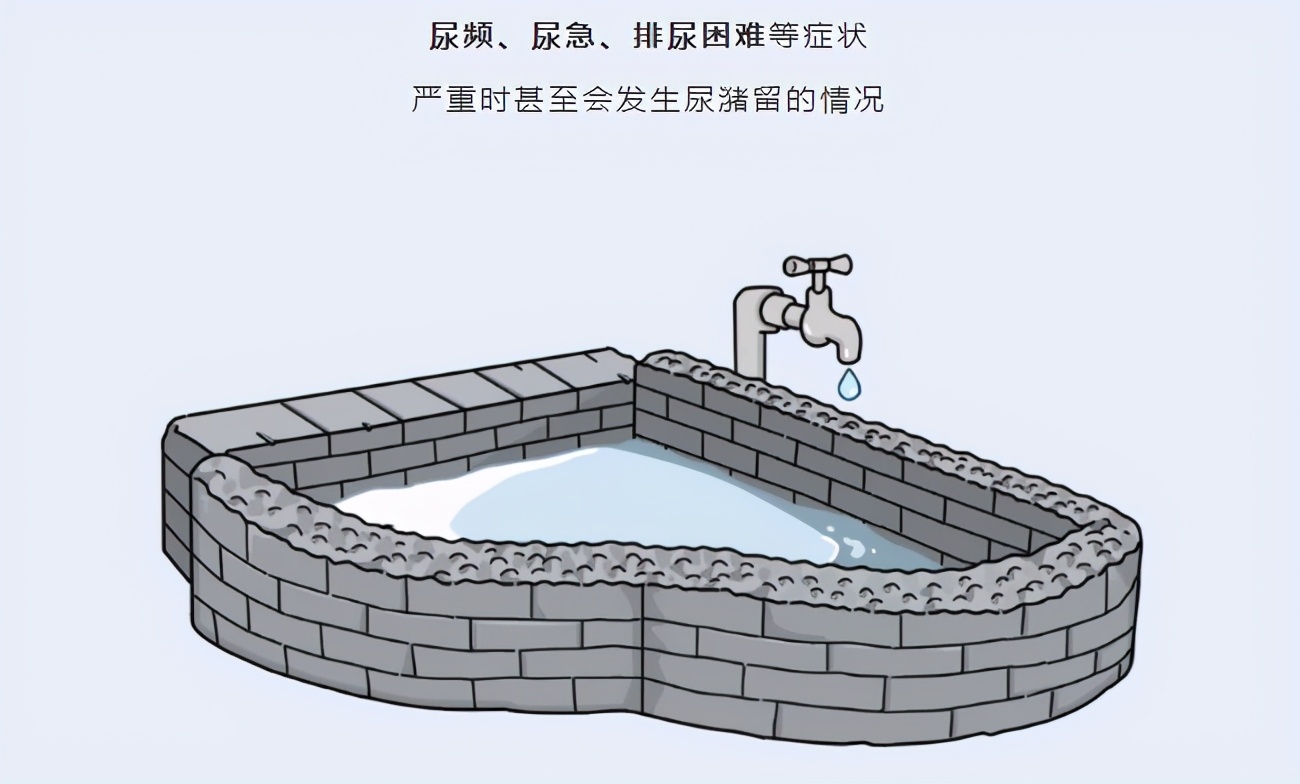 带你了解前列腺，前列腺炎需要检查哪些项目？