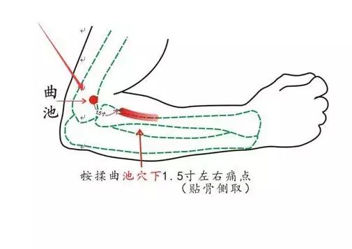 三阴交穴的4种穴位配伍套路，效果不容小觑，祛湿通络、利水消肿
