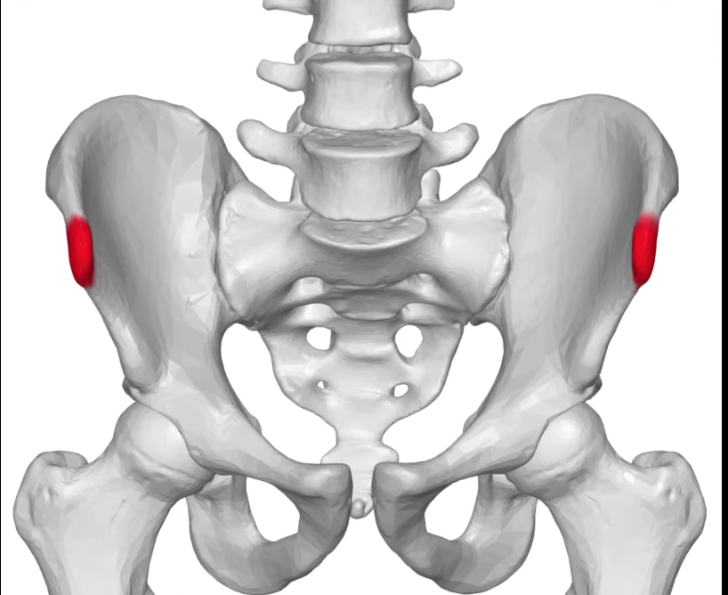 因为骨盆歪掉，所以常常腰酸背痛？如何改善，矫正有用吗？