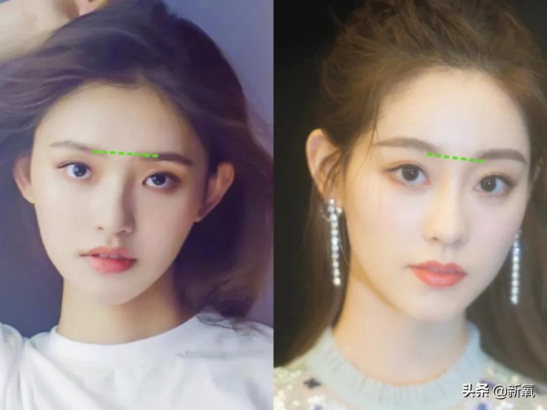 姐妹,双眼皮再好,咱也别硬割啊