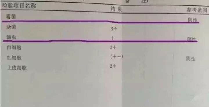 怀孕了,有黄色分泌物怎么回事?四种异常,三种不适,你中了哪点