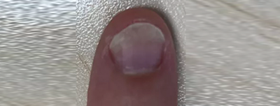 做美甲多久后必须要卸甲？一定要去美甲店卸甲吗？