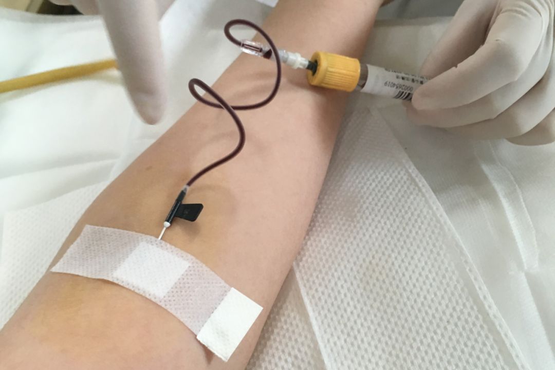 同时我们在医院抽血2小时内使用家用仪器测试4位志愿者的血糖和尿酸值