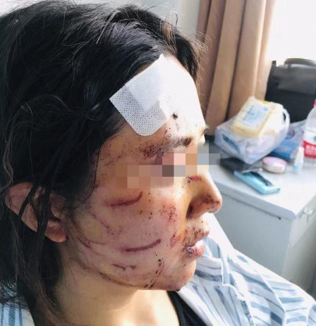 温州女子被打因要200万嫁妆，男方说她偷情 律师称故意伤害侮辱或判3年以下