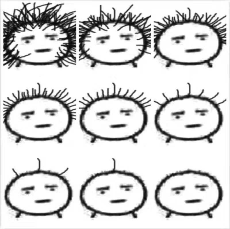 盘点最脱发专业，你的专业上榜了吗？