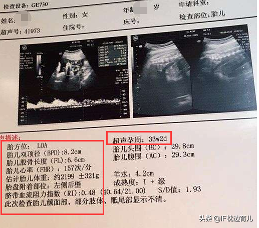 孕期这两个B超检查能不能省一回？医生：一次比一次重要，别错过