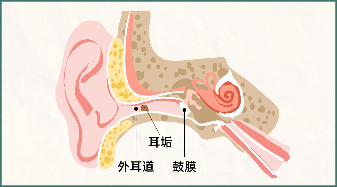 耳屎越掏越多？这样掏耳朵，危害远比想象严重