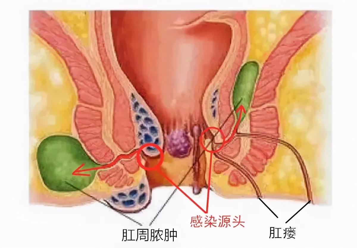 胡子长得快，雄性激素旺盛？别高兴太早，医生告诉您事情的真相