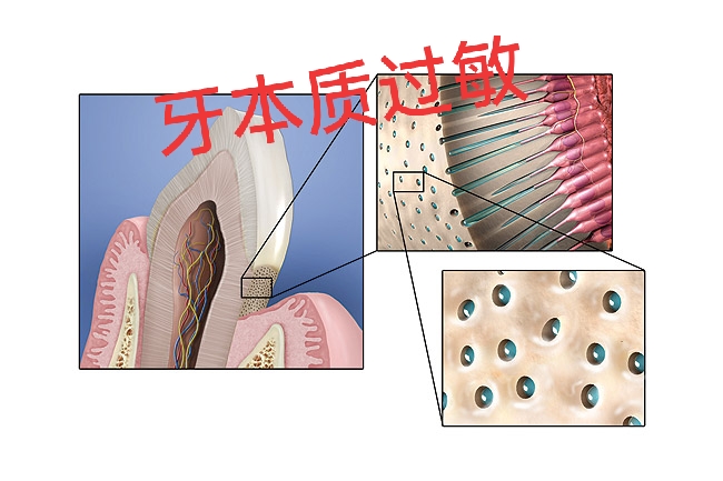 辟谣:牙痛只是小问题，一次就能治好？NO,并不是那么简单