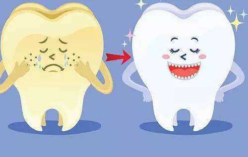牙齿上有牙结石，口臭明显，怎么办？｜口腔医生说先用洁牙来改善