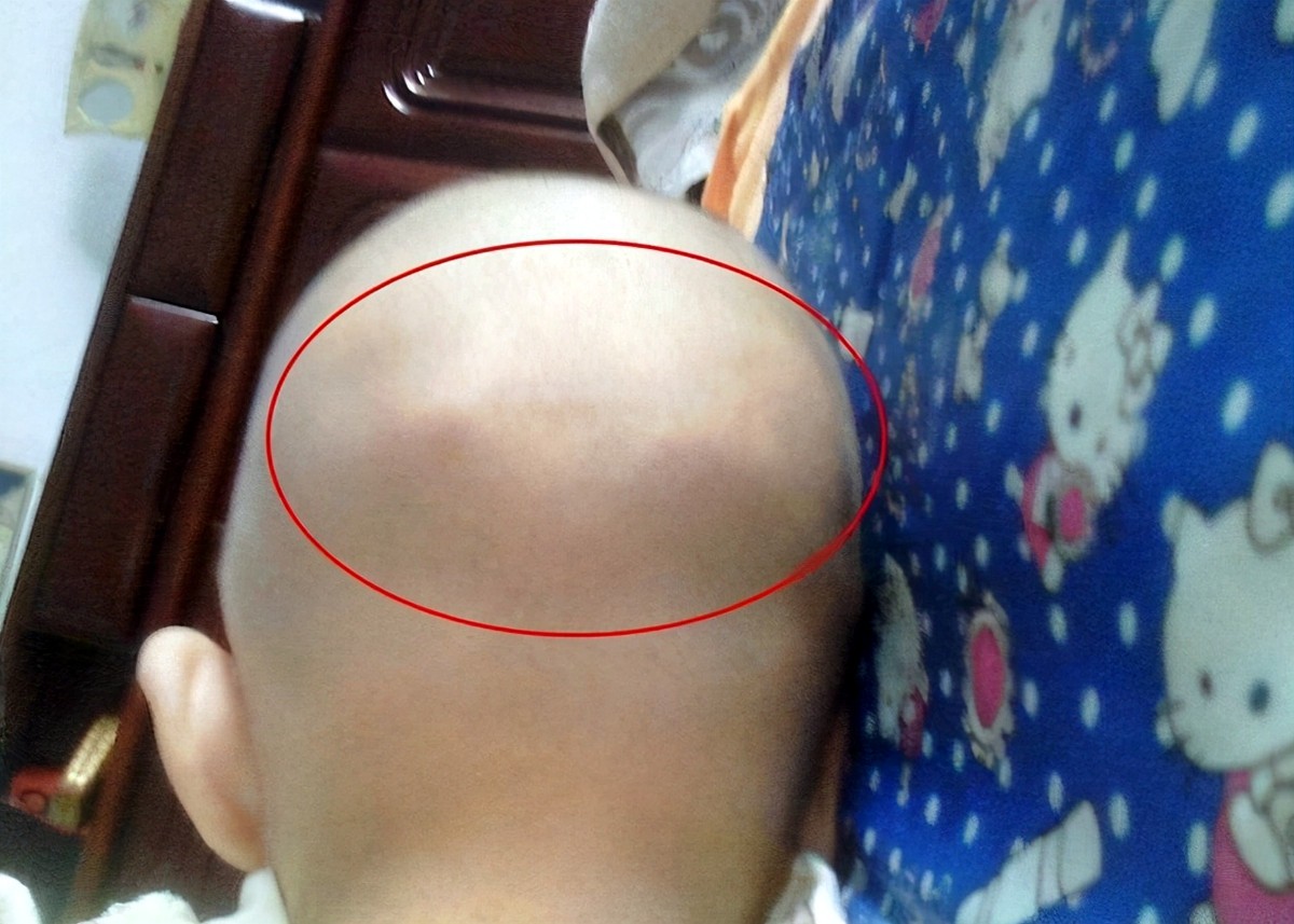 婴儿头(孩子聪不聪明看头型就知道) - 乐宝宝贝