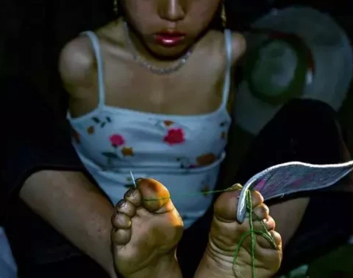 母婴儿哺乳图片(无臂妈妈) - 乐宝宝贝