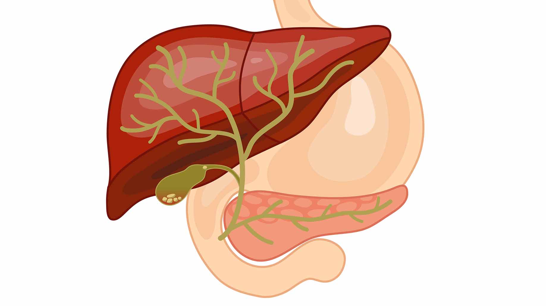 肝弹准确吗？肝病专家详解B超、CT、磁共振等肝硬化的无创检查！